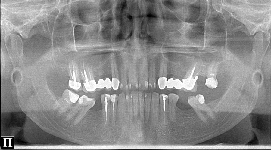 dental1